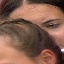 Face f_94261_2