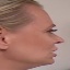 Face f_455311_2