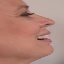 Face f_456121_2