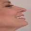 Face f_456151_2