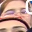 Face f_554491_24