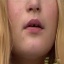 Face f_799231_9