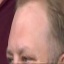 Face f_884431_19
