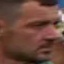 Face f_989881_31