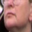 Face f_1001731_22