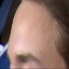 Face f_1012231_11