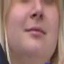 Face f_1016011_20