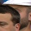Face f_1031101_20