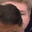 Face f_1215511_25