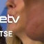 Face f_1308391_3
